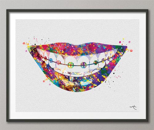 Orthodontist Gift Ideas - Braces Art Print